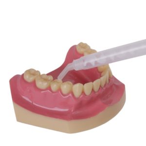 Смесительный наконечник Bite oral tip S122 - применение